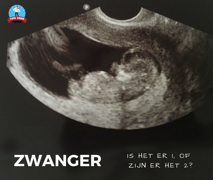 Zwanger - Is Het Er 1, Of Zijn Het Er 2? - Tips Voor Papa's